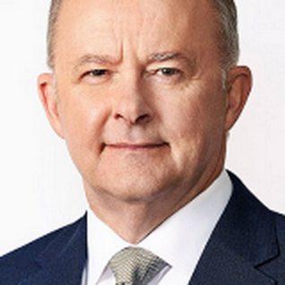 Anthony Albo voice